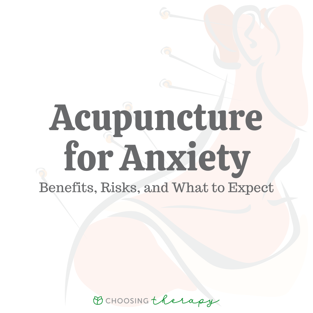 Can Acupuncture Help With Anxiety?