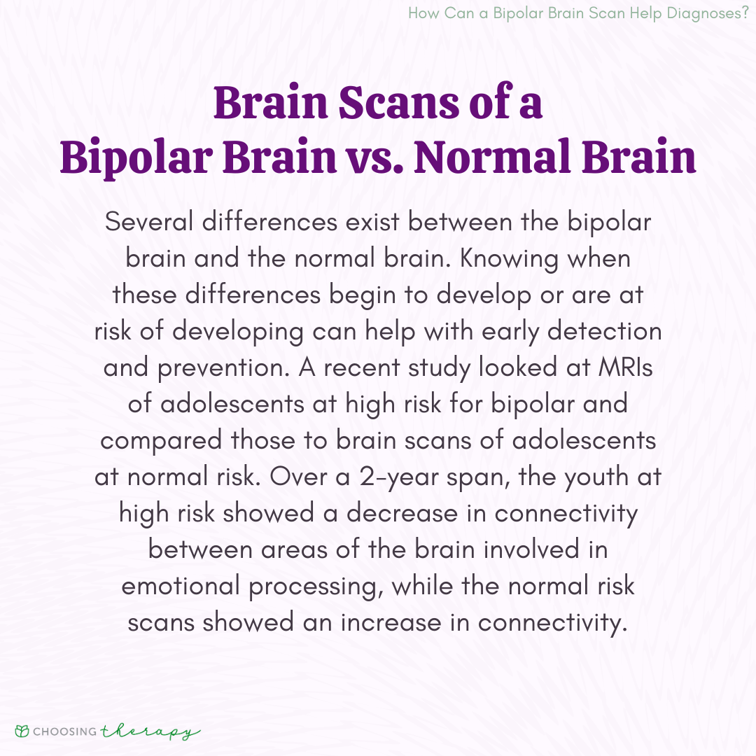 Brain Scans of a Bipolar Brain vs. Normal Brain