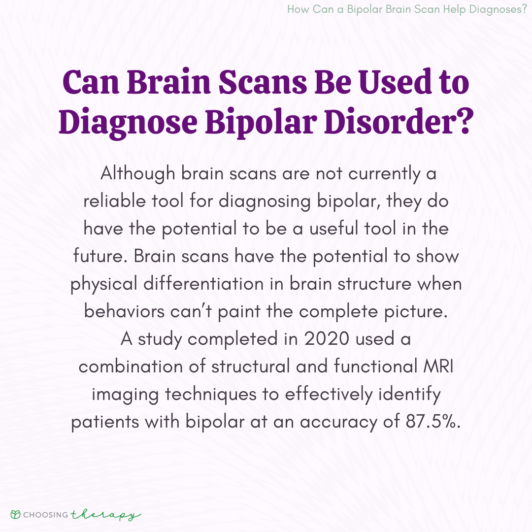 Can Brain Scans Be Used to Diagnose Bipolar Disorder