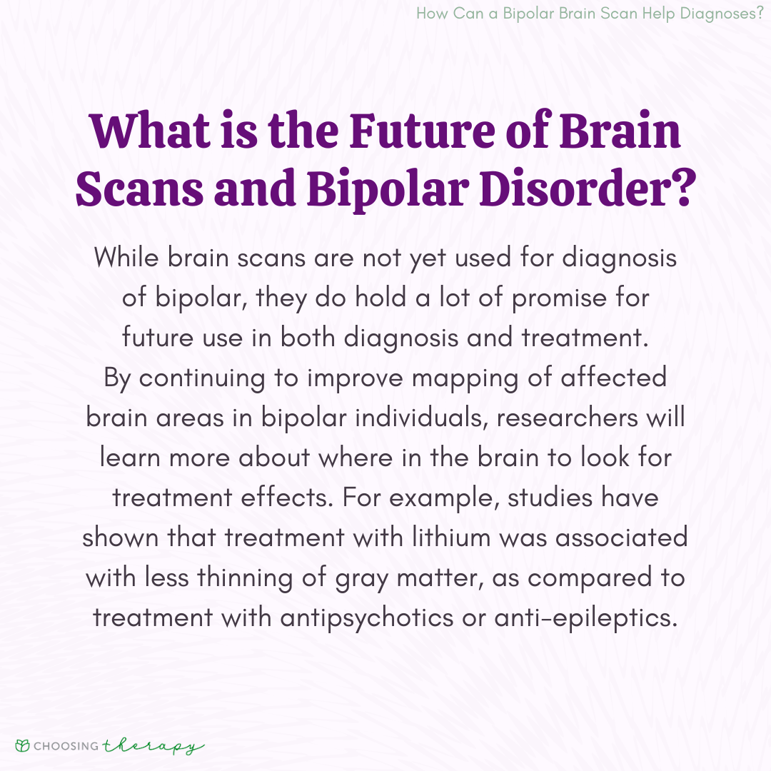 What is the Future of Brain Scans and Bipolar Disorder