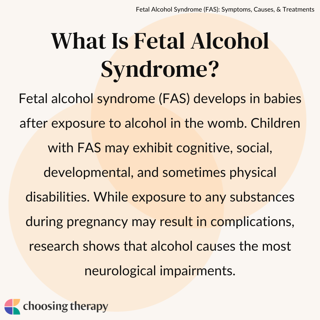 What Is Fetal Alcohol Syndrome?